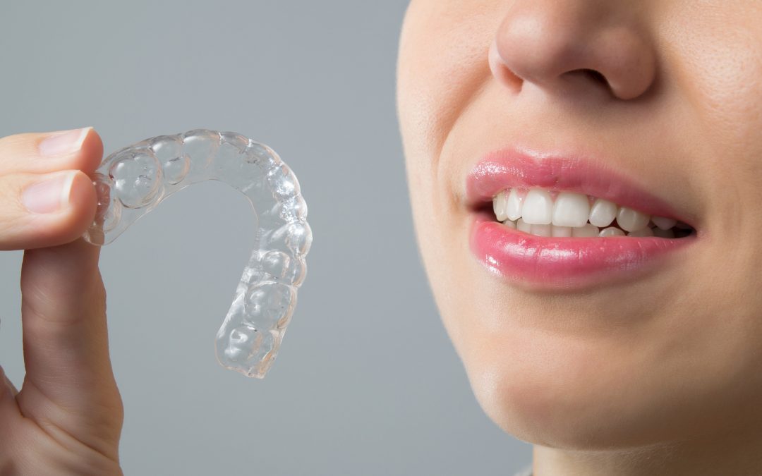 retainer3-1080x675
